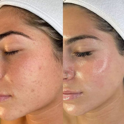 Ultrasonic Skin Scrubber