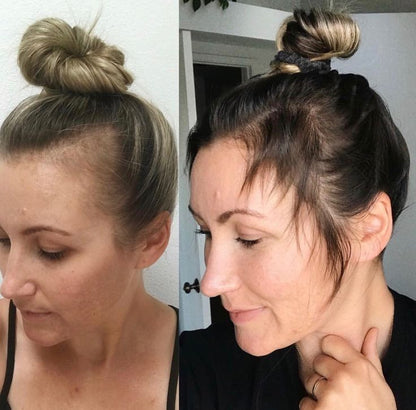 Hair Grower: Electric Scalp Massager